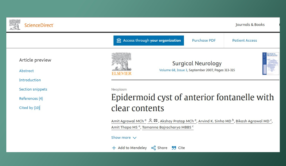 Epidermoid cyst of anterior fontanelle with clear contents
